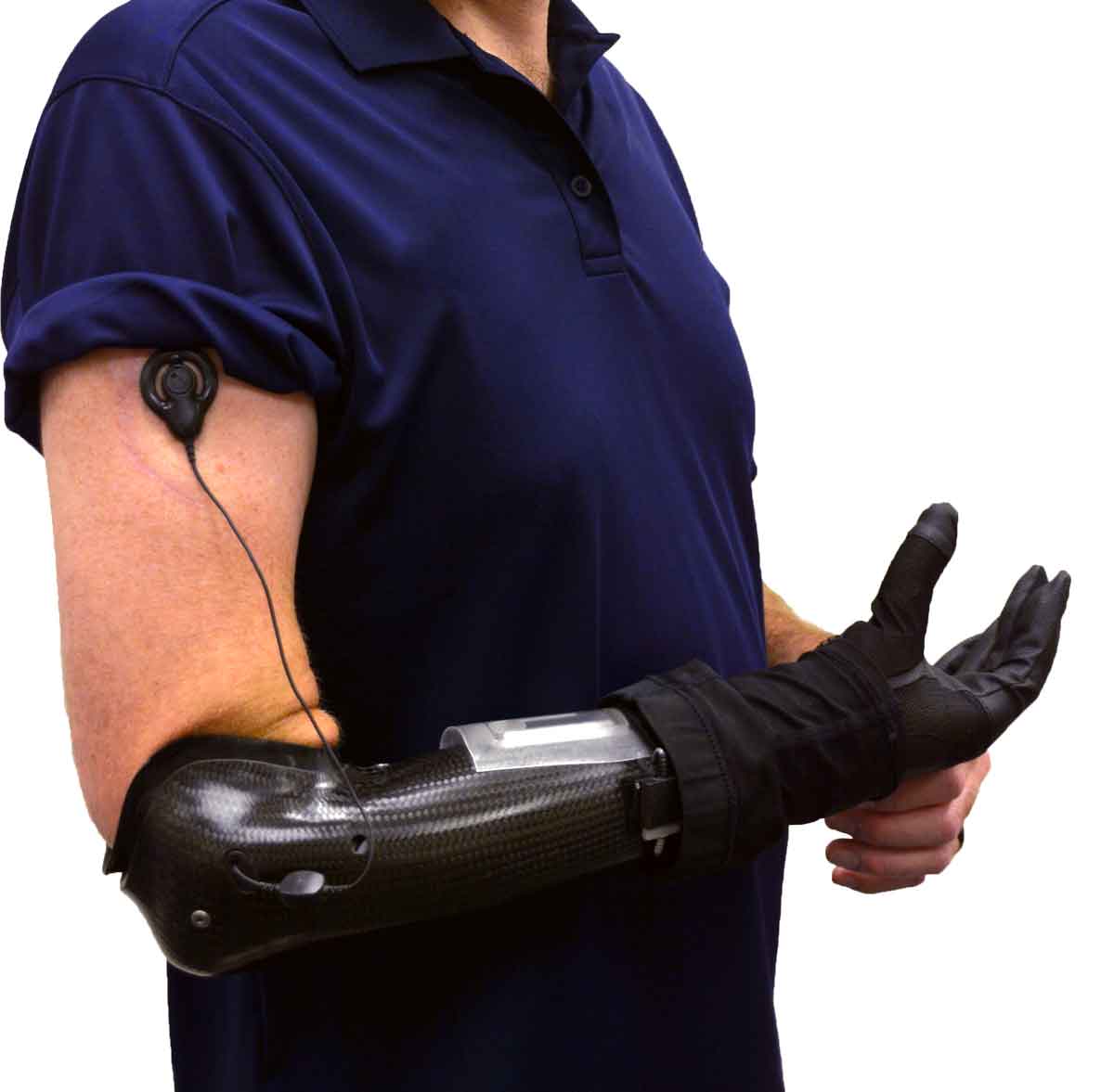 Neural Enabled Prosthesis for Upper Limb Amputees